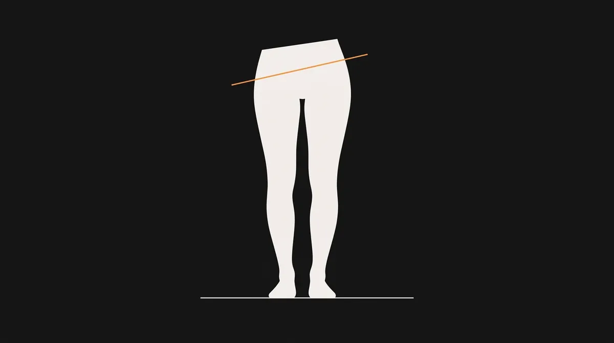 늘 같은 쪽 다리로만 섭니다 — 짝다리·한쪽 가방이 만드는 좌우 비대칭 자가진단 3가지